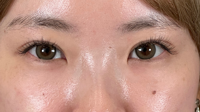 Postoperative Condition Part 1