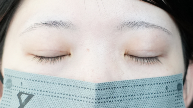 手术前的状态 其一