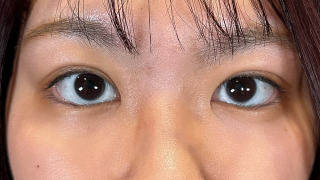 手术前的状态 其一