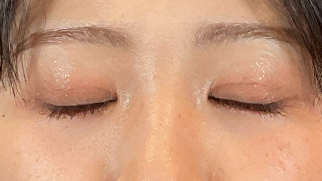 手术前的状态 其一