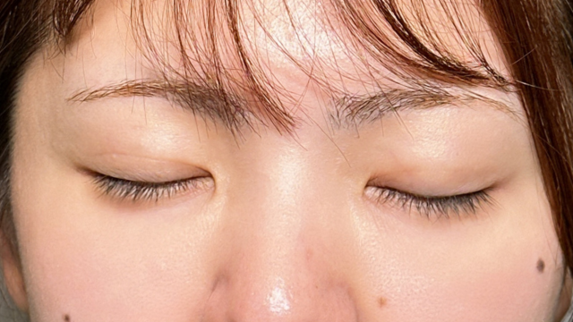 手术前的状态 其一