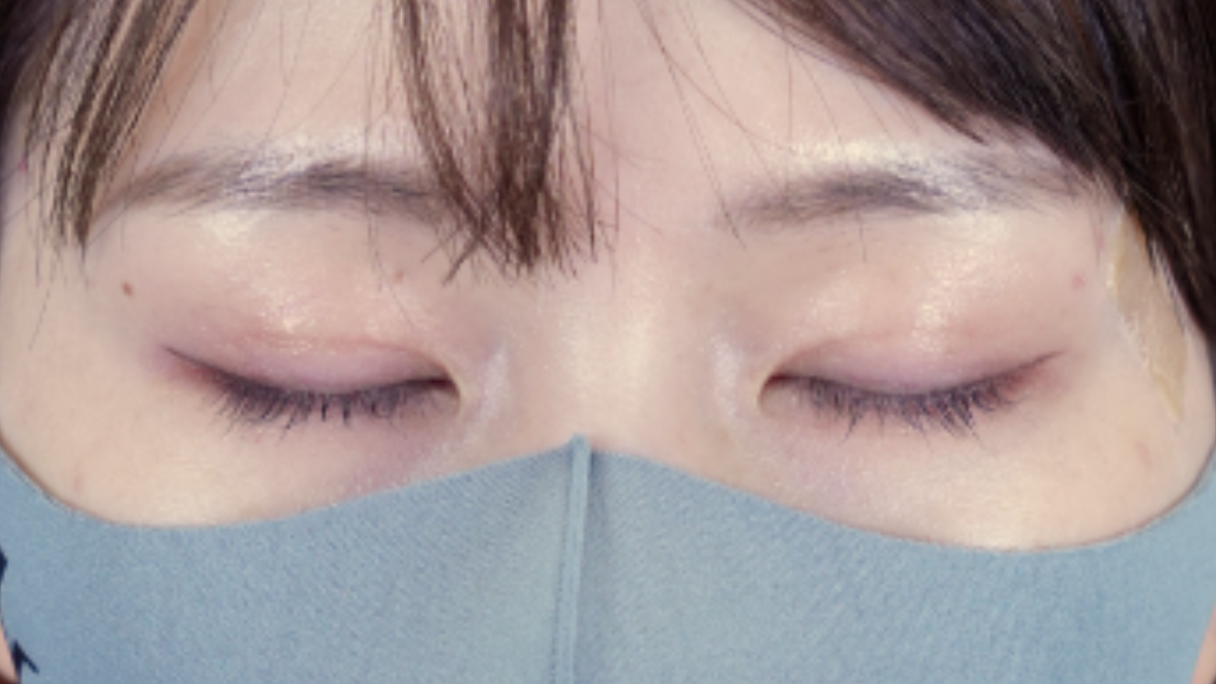 手术前的状态 其一