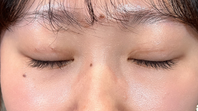 Postoperative Condition Part 1