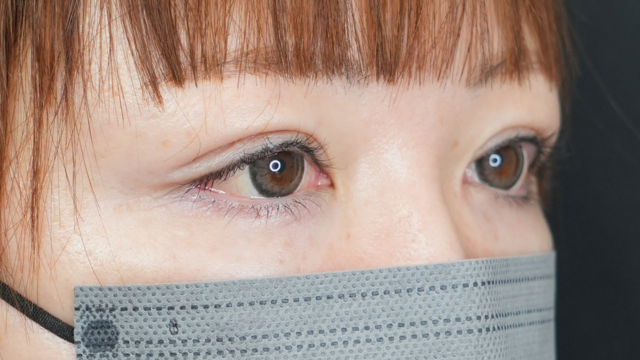 手术前的状态 其一