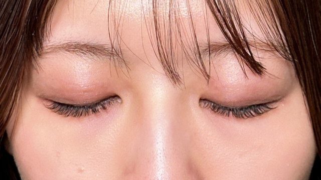 手术前的状态 其一