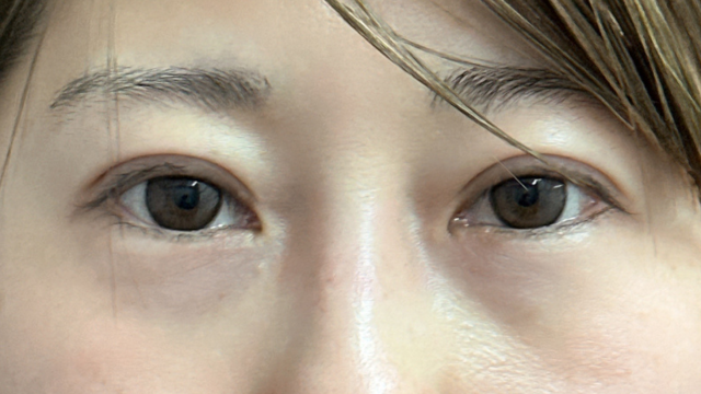 手术前的状态 其一