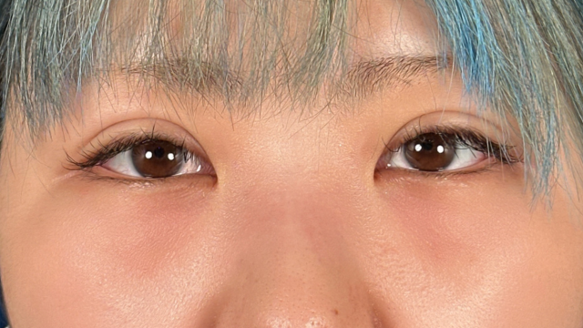 手术前的状态 其一