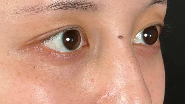 手术前的状态 其一