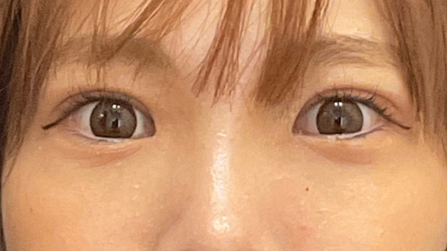 手术前的状态 其一