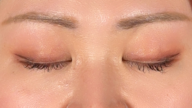 Postoperative Condition Part 1