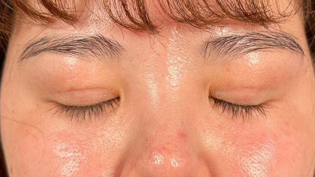 手术前的状态 其一