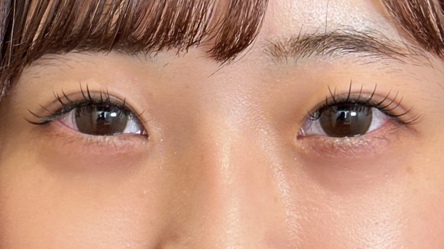 手术前的状态 其一