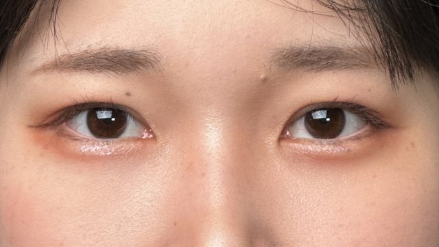 Postoperative Condition Part 1