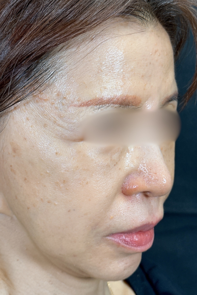 手術前の状態 その1