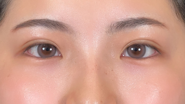 手术前的状态 其一