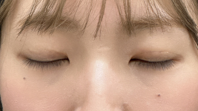 手术前的状态 其一