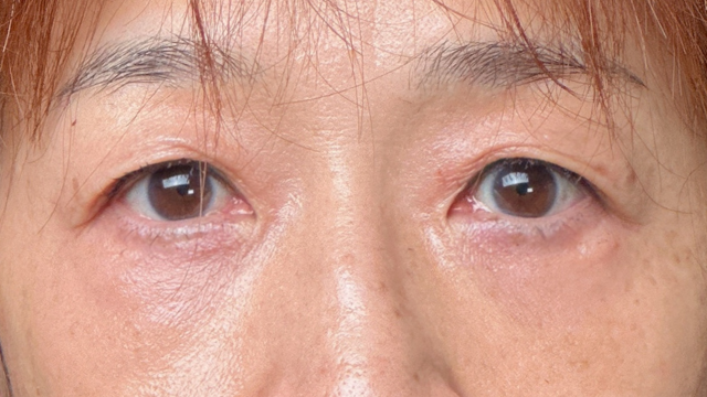 手术前的状态 其一