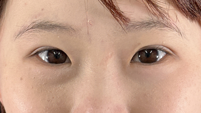 Postoperative Condition Part 1