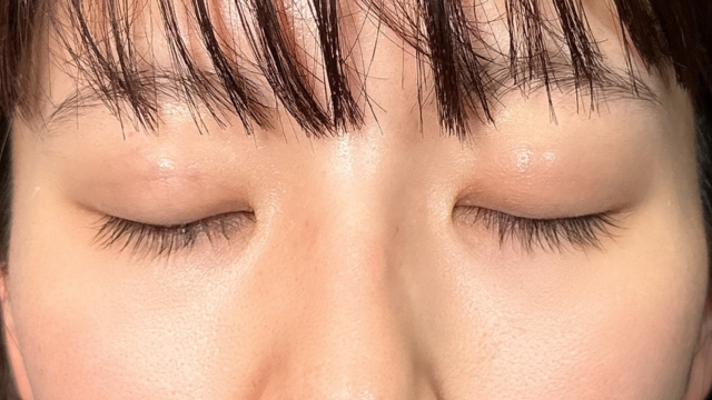 手术前的状态 其一