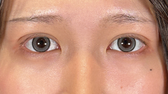 手术前的状态 其一