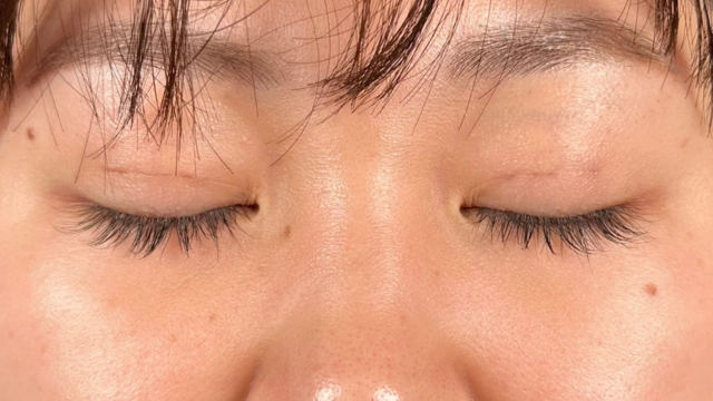 Postoperative Condition Part 1