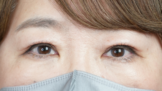 Postoperative Condition Part 1