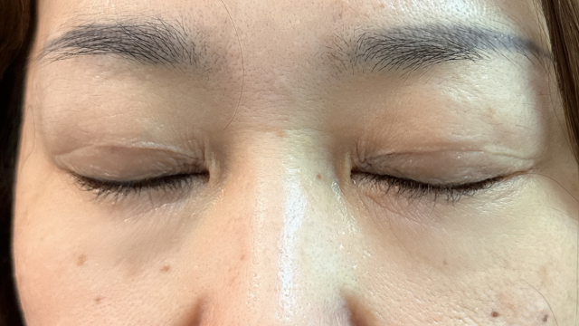 Postoperative Condition Part 1