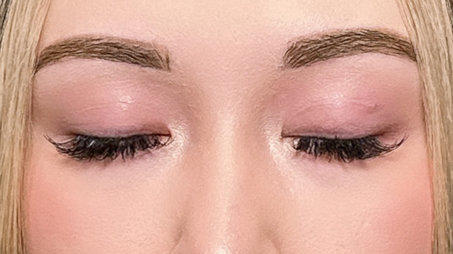 手术前的状态 其一