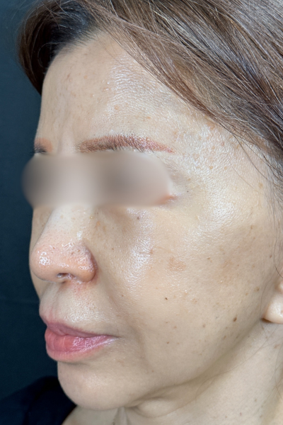 手術前の状態 その1