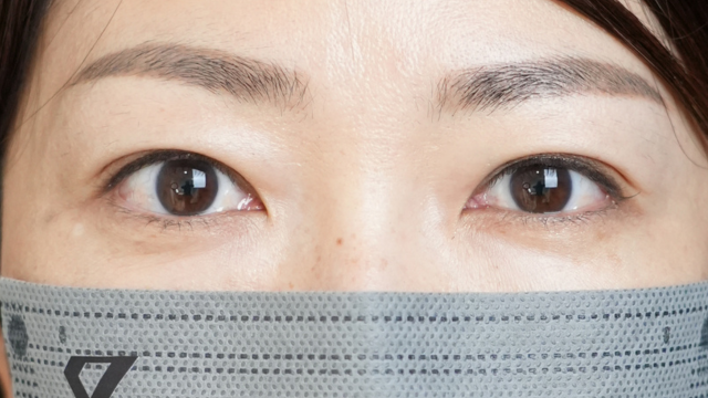 手术前的状态 其一