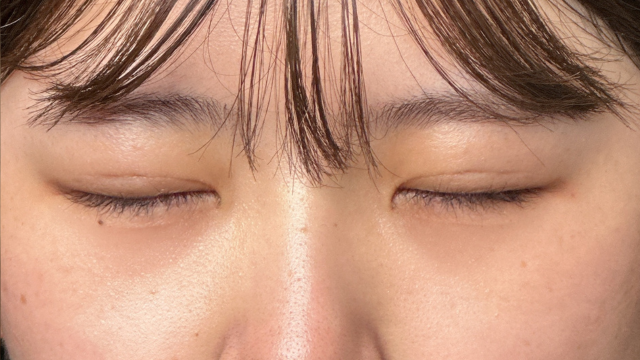 手术前的状态 其一