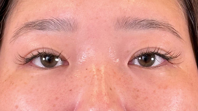 手术前的状态 其一