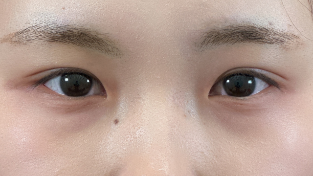 Postoperative Condition Part 1