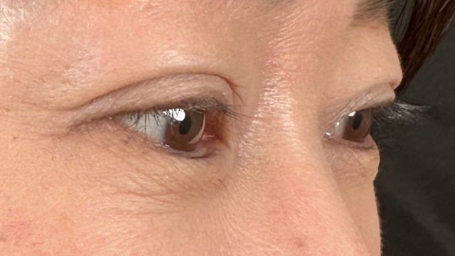 手術前の状態 その1