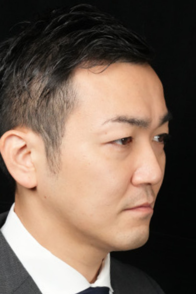 手術前の状態 その1