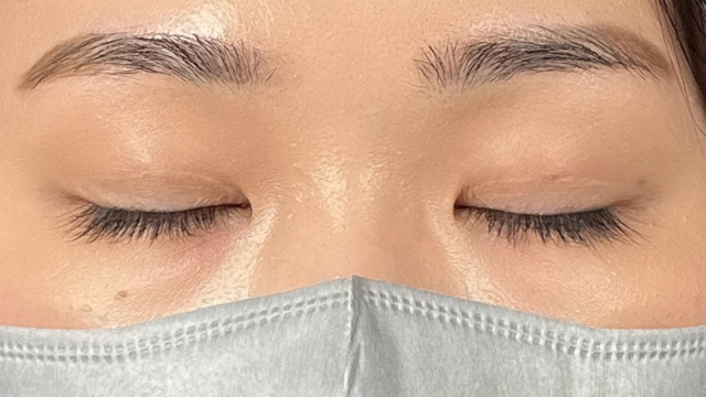 手術前の状態 その1