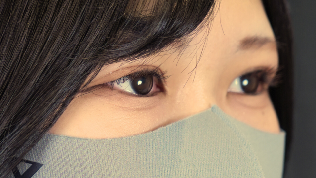 手術前の状態 その1