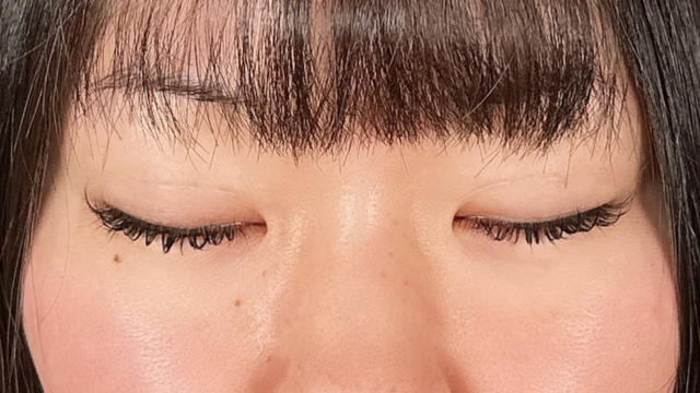 手术前的状态 其一