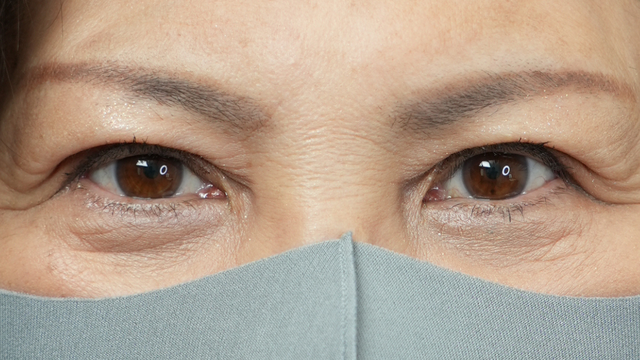 手术前的状态 其一