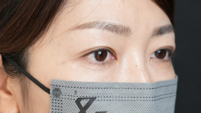 手术前的状态 其一