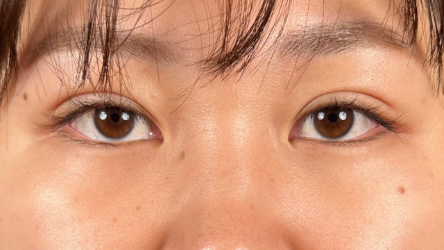 Postoperative Condition Part 1