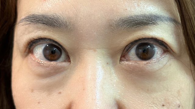 Postoperative Condition Part 1