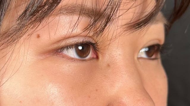 Postoperative Condition Part 1