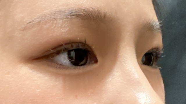 手术前的状态 其一