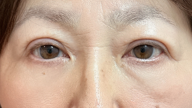 手术前的状态 其一