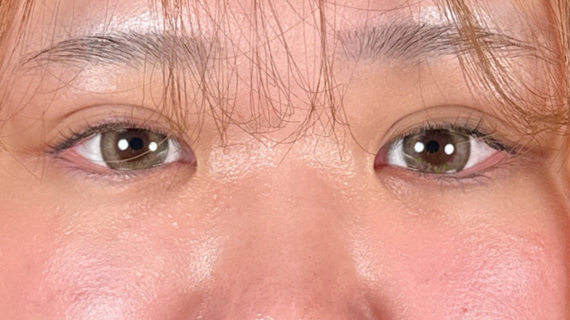 手术前的状态 其一