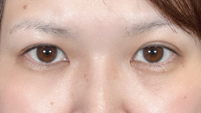 Postoperative Condition Part 1