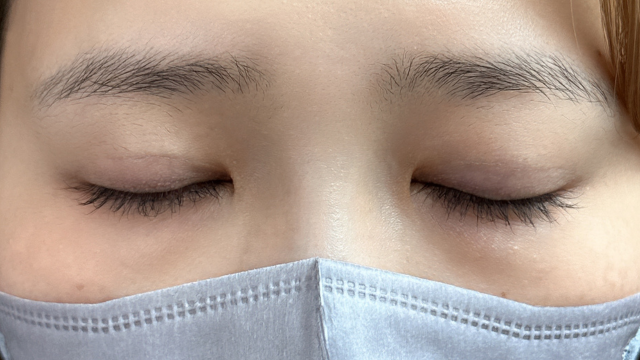 手术前的状态 其一