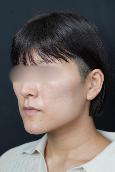 手术前的状态 其一