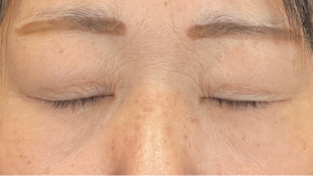 手术前的状态 其一